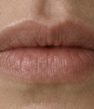 Skin closeup
